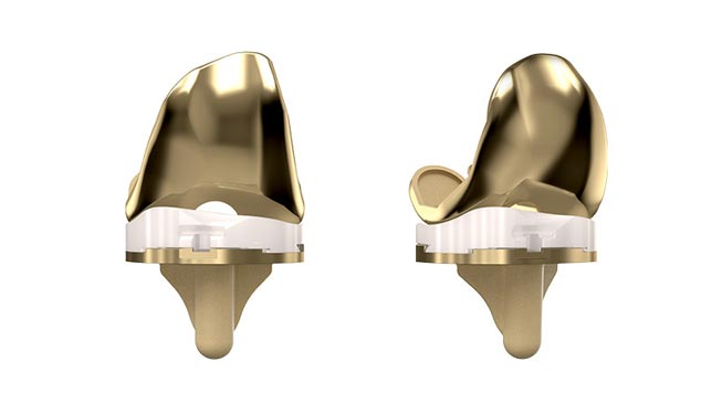 Evolution NitrX Medial-Pivot Knee with TiNbN coating