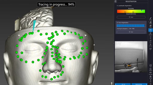 Navient software: navigation view