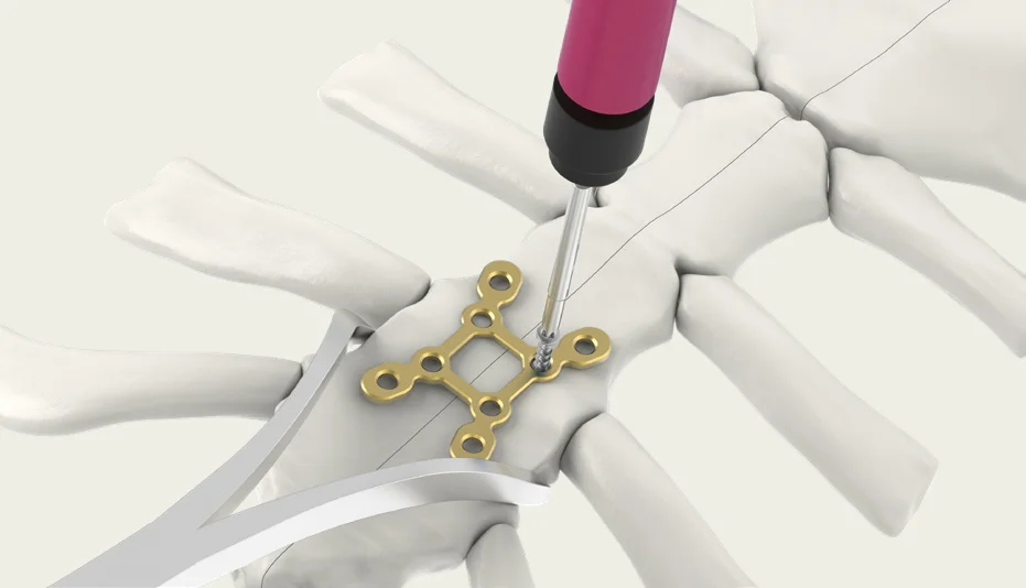 Step 5: tighten
