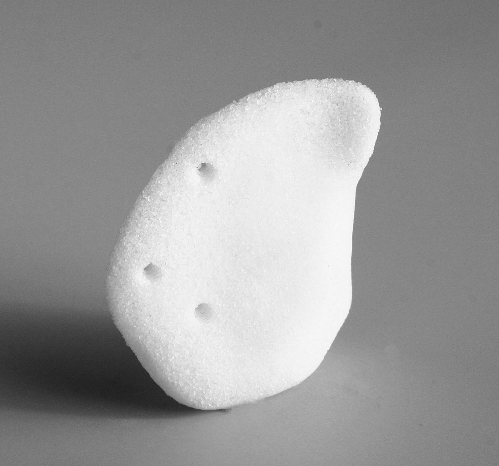 Su-Por pterional 3D implant