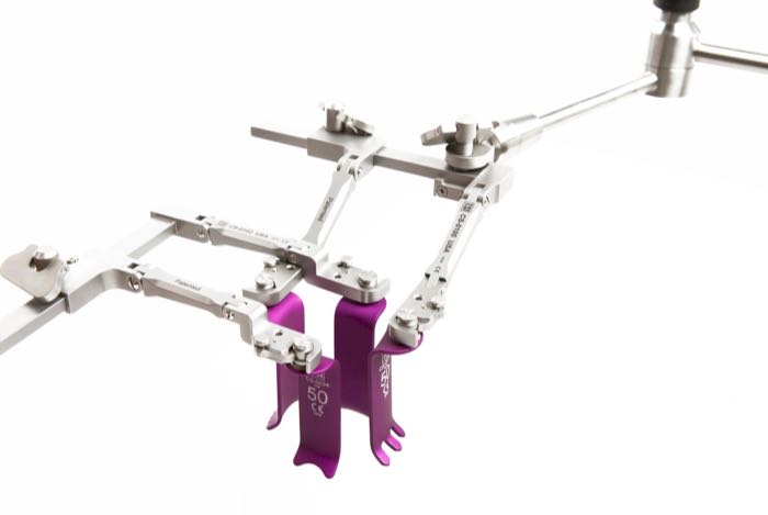 TeDan surgical retractors