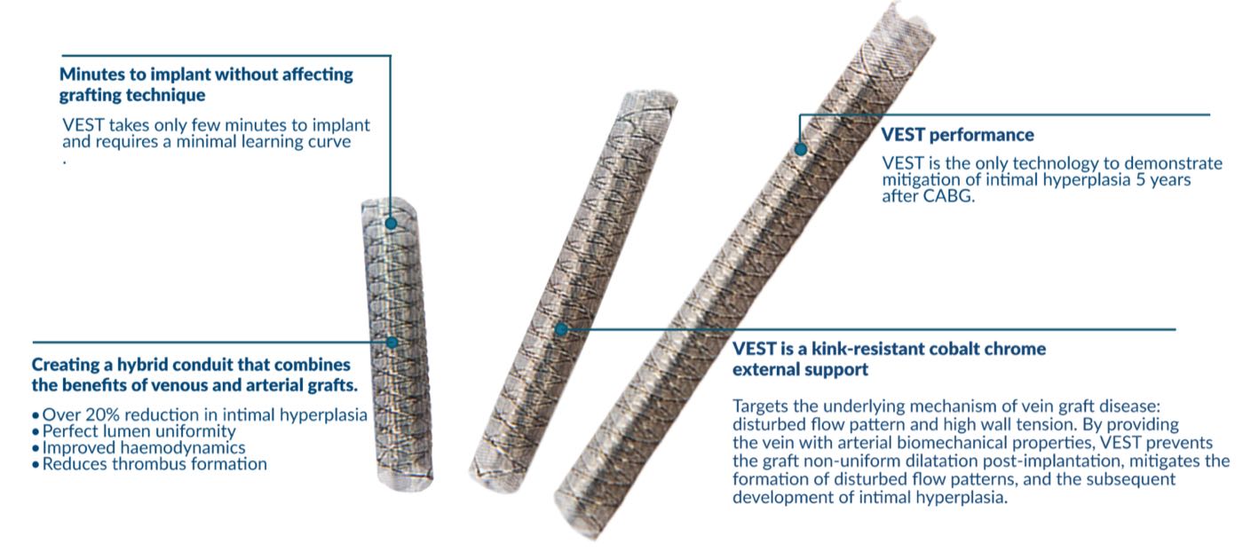 VEST features and benefits